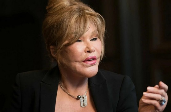 «Կին-կատու». Կյանքը պլաստիկ վիրահատությունից առաջ և հետո