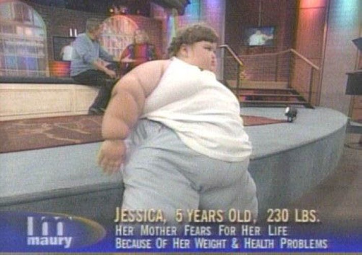 Ինչպի՞սի տեսք ունի աշխարհի ամենագեր աղջիկն այժմ` նիհարելուց հետո