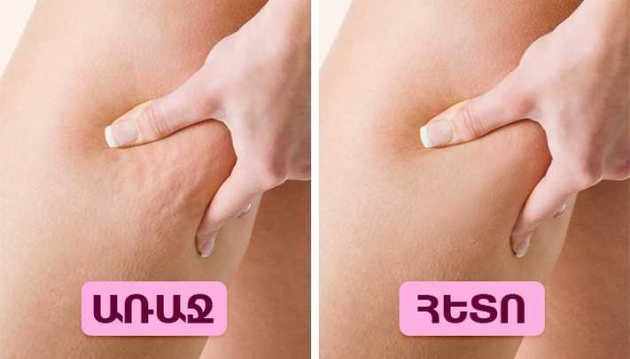 Մաշկի և մազերի առողջության այս արդյունավետ միջոցը կա ցանկացած տանը, սակայն քչերը գիտեն այդ մասին