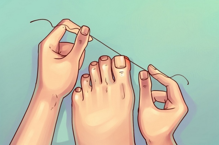 6 ֆանտաստիկ խորհուրդ՝ ոտքերն ու մատներն անթերի տեսքի բերելու և պահպանելու համար