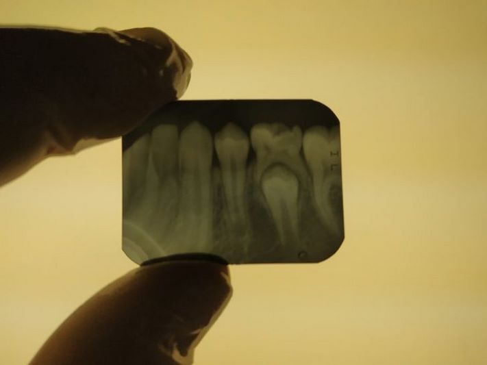 19 ռենտգենյան լուսանկարներ, որոնք շատ հետաքրքիր բաներ են բացահայտում