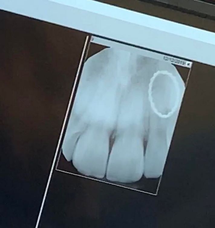 19 ռենտգենյան լուսանկարներ, որոնք շատ հետաքրքիր բաներ են բացահայտում