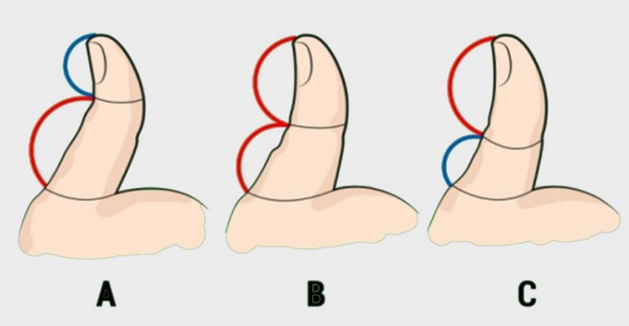 Թեստ. Որոշում ենք բնավորությունը ըստ բթամատի ֆալանգի երկարության
