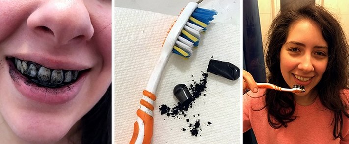 Բացարձակ անվնաս միջոց, որը կօգնի կարճ ժամանակում սպիտակեցնել ատամները․ արդյունքը երեք օրից կնկատեք