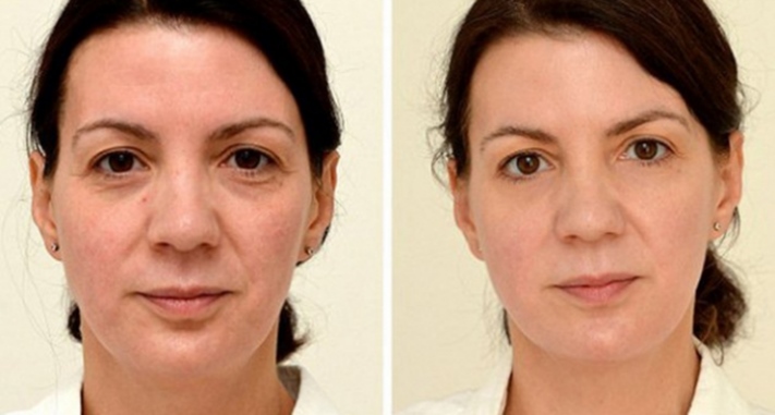 3 ամիս առաջ ես սկսեցի խմել ջուր սոված փորին. Հետազոտության արդյունքներից անգամ բժիշկն էր ապշած