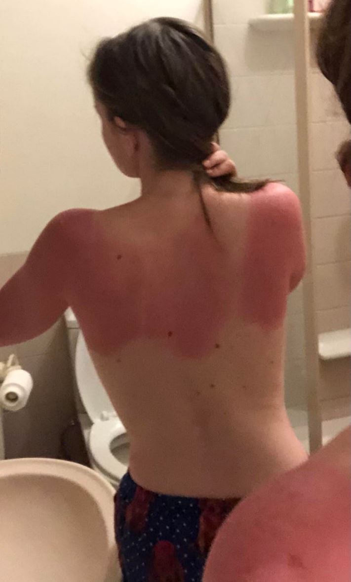 19 լուսանկար տոտալ անհաջողություններից, որոնք հետապնդում են այս լուսանկարների հերոսներին իրենց ողջ կյանքի ընթացքում