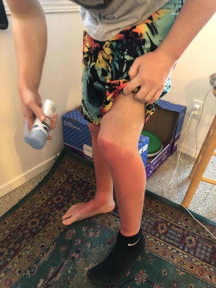 Իրավիճակների 30 լուսանկար, որոնցում ոչ ոք չէր ցանկանա լինել, բայց ոչ ոք էլ դրանցից ապահովագրված չէ