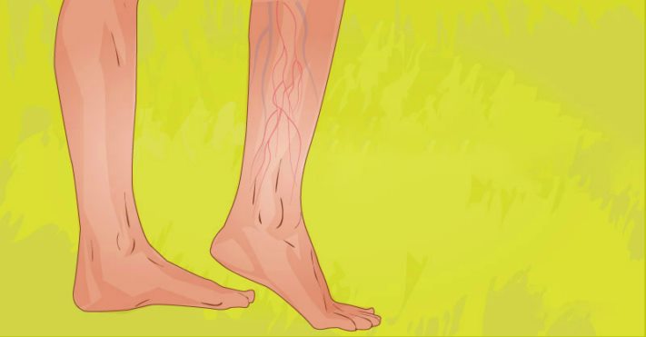 Տրոմբի 6 նշան, որոնք ոչ մի դեպքում չի կարելի անտեսել