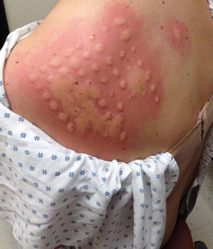 Իրավիճակների 30 լուսանկար, որոնցում ոչ ոք չէր ցանկանա լինել, բայց ոչ ոք էլ դրանցից ապահովագրված չէ