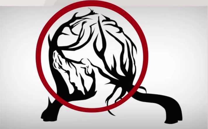 Հոգեբանական թեստ. Ի՞նչ տեսաք առաջինը նկարում: Պատասխանը կօգնի ձեզ հասկանալ, թե ինչն է պակասում ձեզ երջանկության համար