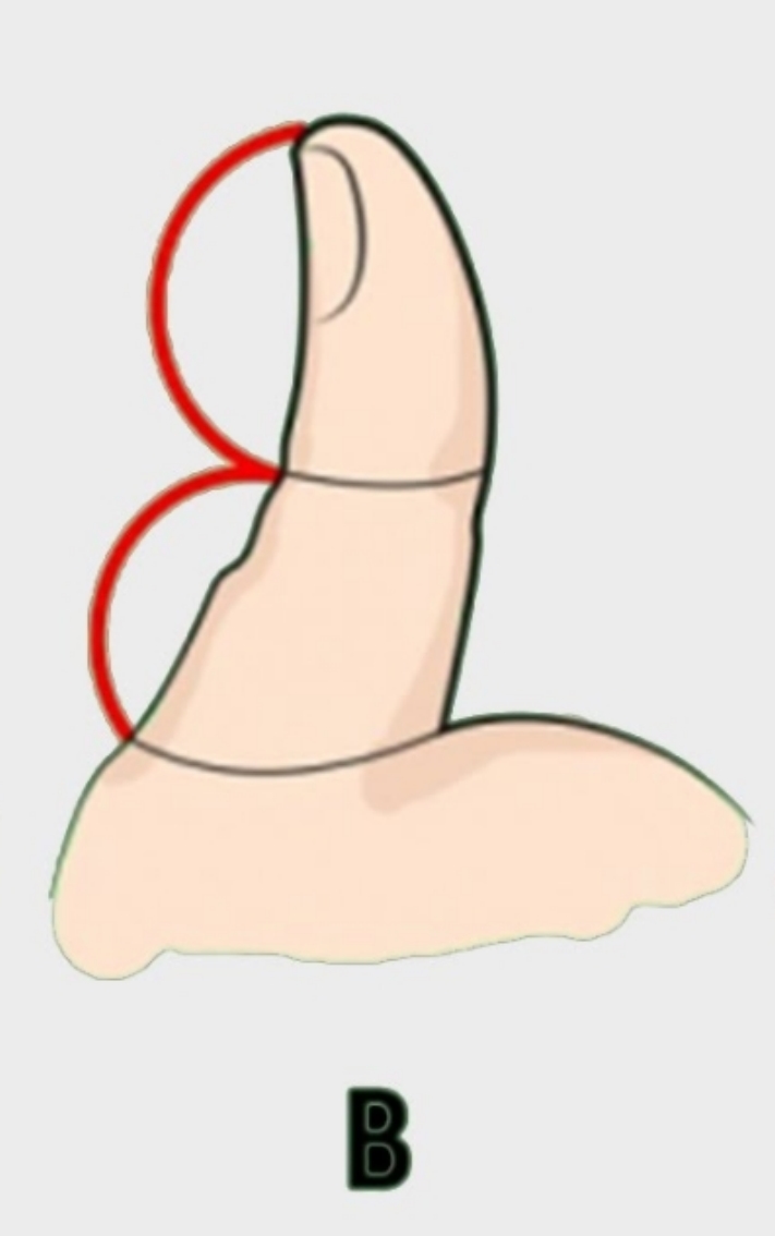 Թեստ. Որոշում ենք բնավորությունը ըստ բթամատի ֆալանգի երկարության