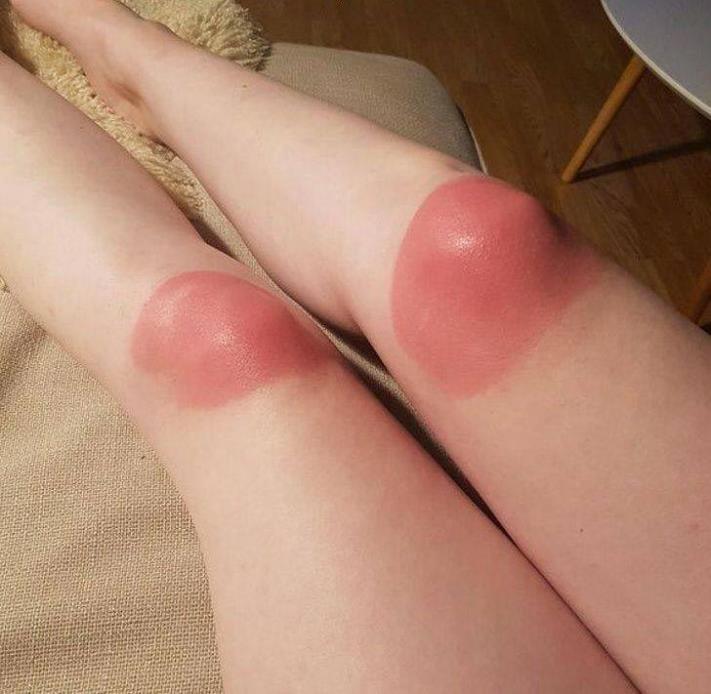 Իրավիճակների 30 լուսանկար, որոնցում ոչ ոք չէր ցանկանա լինել, բայց ոչ ոք էլ դրանցից ապահովագրված չէ