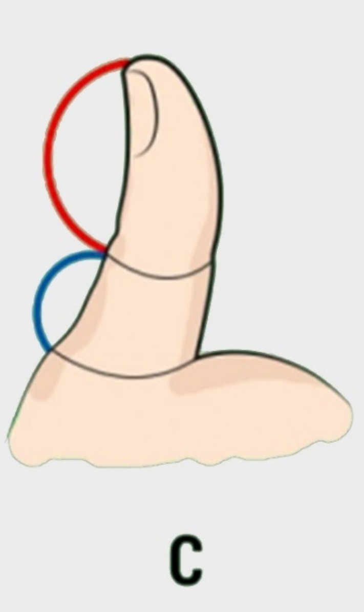 Թեստ. Որոշում ենք բնավորությունը ըստ բթամատի ֆալանգի երկարության