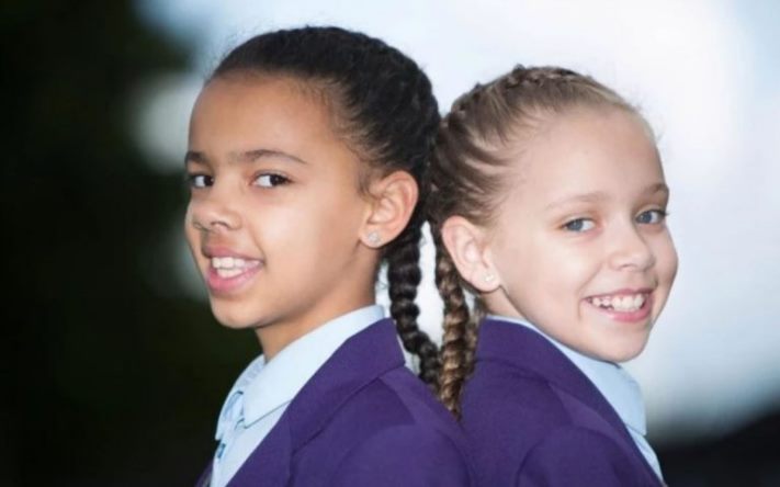 Գենետիկայի ուժը։ Եզակի և հետաքրքիր առանձնահատկություններով ծնված մարդկանց 11 լուսանկար