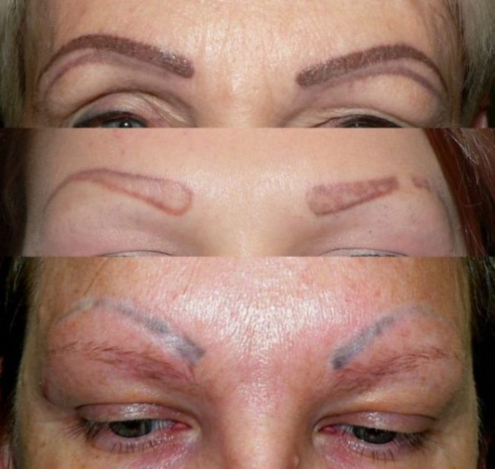 Երբ հոնքերի վարպետի հարցում բախտդ չի բերում. Կանանց 12 լուսանկար, որոնց հոնքերին չես ցանկանում նայել