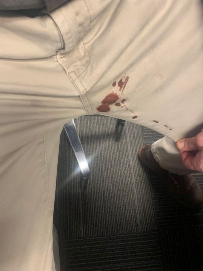 Ճակատագրի անբարեհաճությունն իրենց մաշկի վրա ապրած դժբախտ մարդկանց 16 լուսանկար