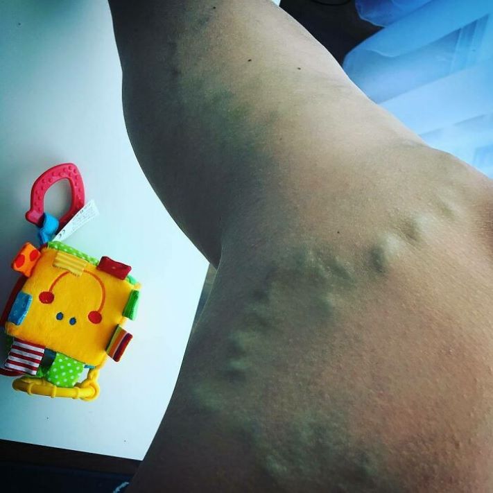 Խնդիրներ, որոնց բախվել են գրեթե բոլոր հղի կանայք` նորածնին կրելիս