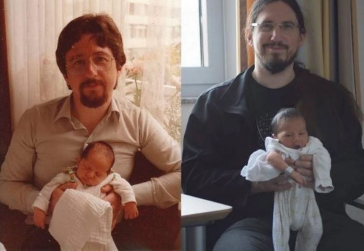 Գենետիկայի ուժը։ Եզակի և հետաքրքիր առանձնահատկություններով ծնված մարդկանց 11 լուսանկար