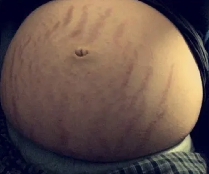 Խնդիրներ, որոնց բախվել են գրեթե բոլոր հղի կանայք` նորածնին կրելիս