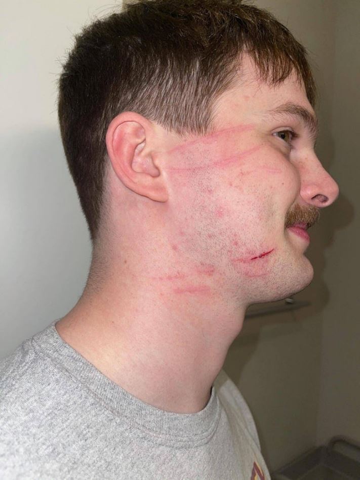 Ճակատագրի անբարեհաճությունն իրենց մաշկի վրա ապրած դժբախտ մարդկանց 16 լուսանկար