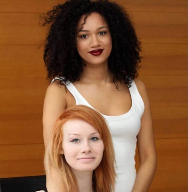 Գենետիկայի ուժը։ Եզակի և հետաքրքիր առանձնահատկություններով ծնված մարդկանց 11 լուսանկար