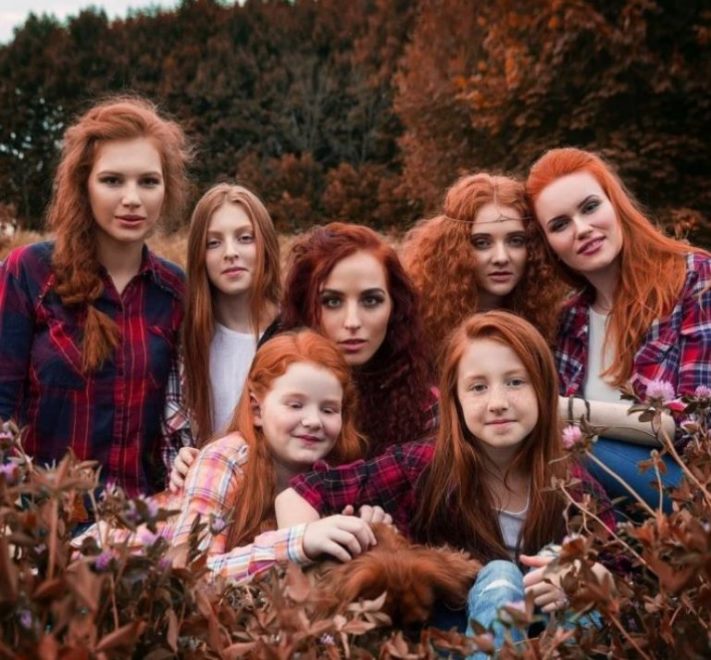 Գենետիկայի ուժը։ Եզակի և հետաքրքիր առանձնահատկություններով ծնված մարդկանց 11 լուսանկար