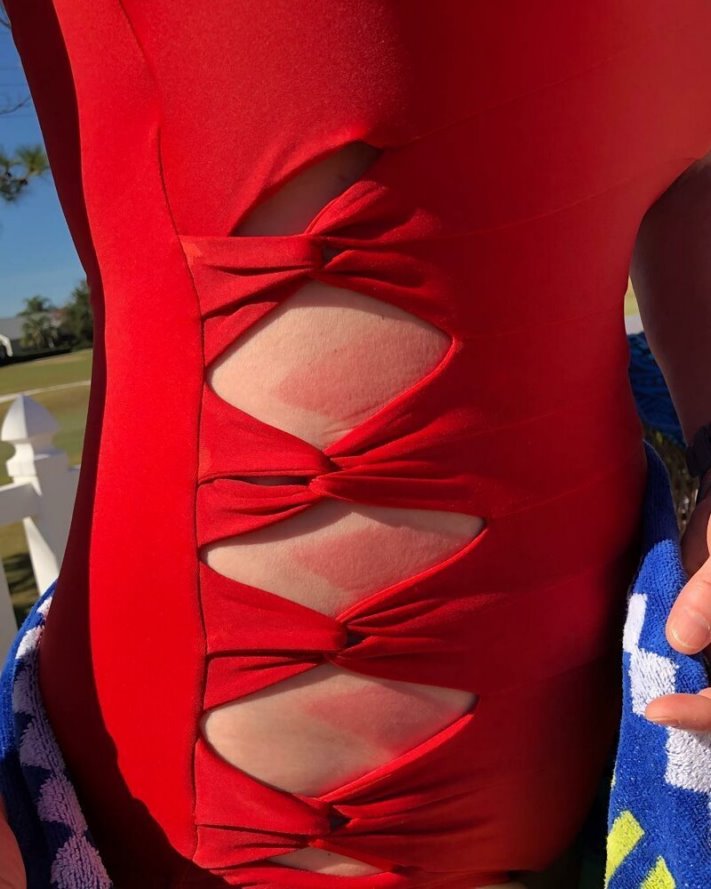 20 սարսափելի արձակուրդային լուսանկարներ, որոնցով դուք չեք կարող պարծենալ ձեր ընկերների մոտ