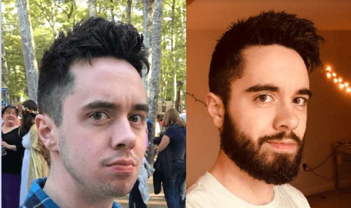 20 օրինակ, թե ինչու յուրաքանչյուր տղամարդ պետք է փորձի մորուք պահել