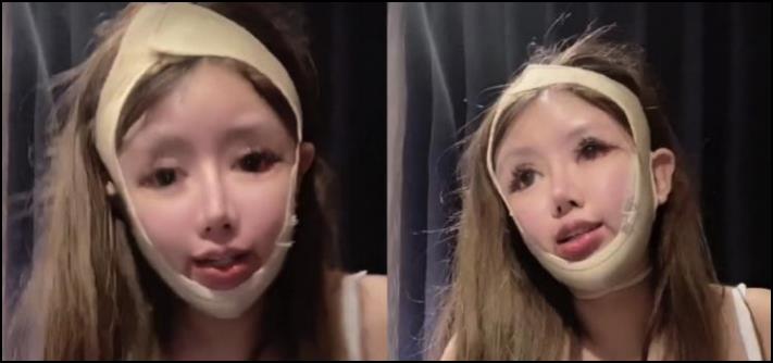 Ահա թե ինչպիսի տեսք ունի 16-ամյա չինուհին, ով 3 տարվա ընթացքում 100 պլաստիկ վիրահատություն է կատարել