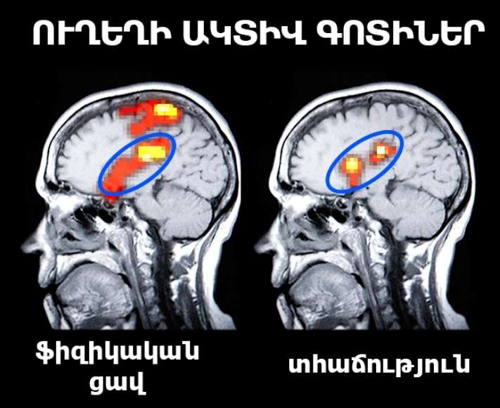Ինչպես մեկընդմիշտ երջանկանալ․ 5 օգտակար խորհուրդ նյարդաբաններից