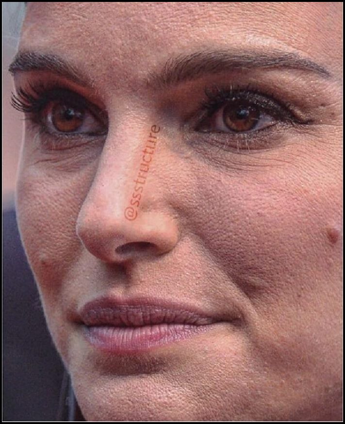 Բեղիկներ, ծակոտիներ և ցաներ: Ինչպիսին են համաշխարհային աստղերի դեմքերը մոտիկից