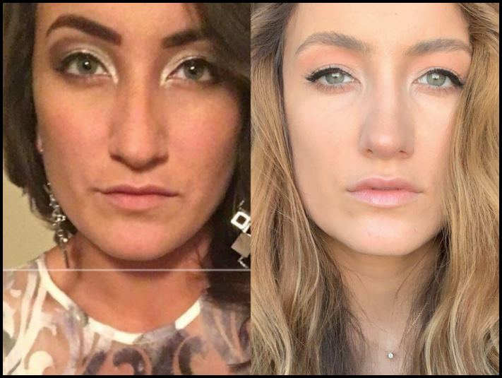 15 մարդ, ովքեր որոշեցին պլաստիկ վիրահատության ենթարկվել և այժմ միայն ափսոսում են, որ դա ավելի վաղ չեն արել