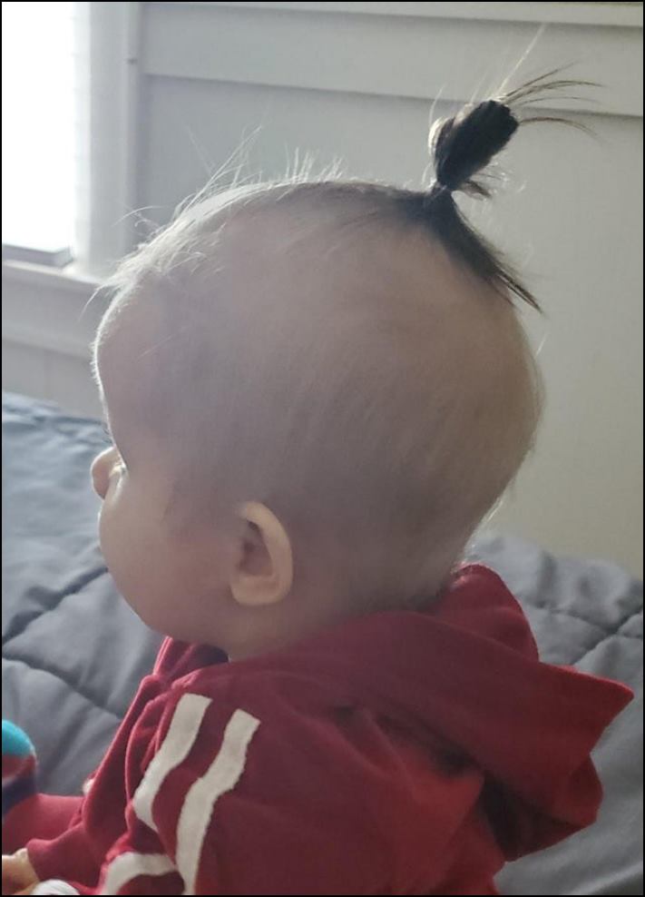 Մարդկանց 16 լուսանկար, որոնց մարմնի անսովոր հատկությունները նրանց տերերին առանձնացնում են մյուսներից