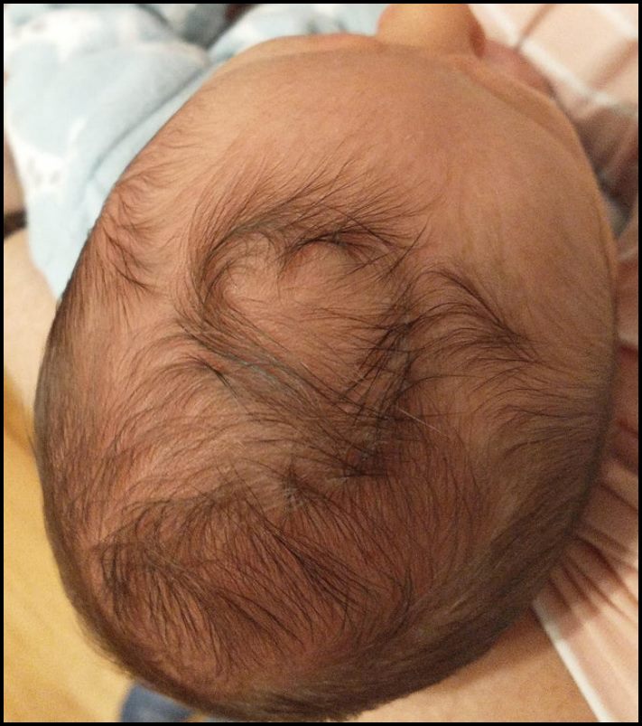 Մարդկանց անհավանական, բայց բավականին իրական մուտացիաներ. 16 լուսանկարների ընտրանի առանց Photoshop-ի