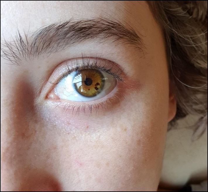 Մարդկանց 16 լուսանկար, որոնց մարմնի անսովոր հատկությունները նրանց տերերին առանձնացնում են մյուսներից