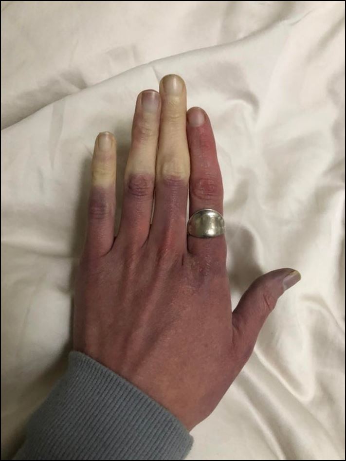 Մարդկանց 16 լուսանկար, որոնց մարմնի անսովոր հատկությունները նրանց տերերին առանձնացնում են մյուսներից