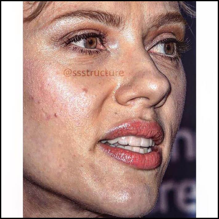 Բեղիկներ, ծակոտիներ և ցաներ: Ինչպիսին են համաշխարհային աստղերի դեմքերը մոտիկից