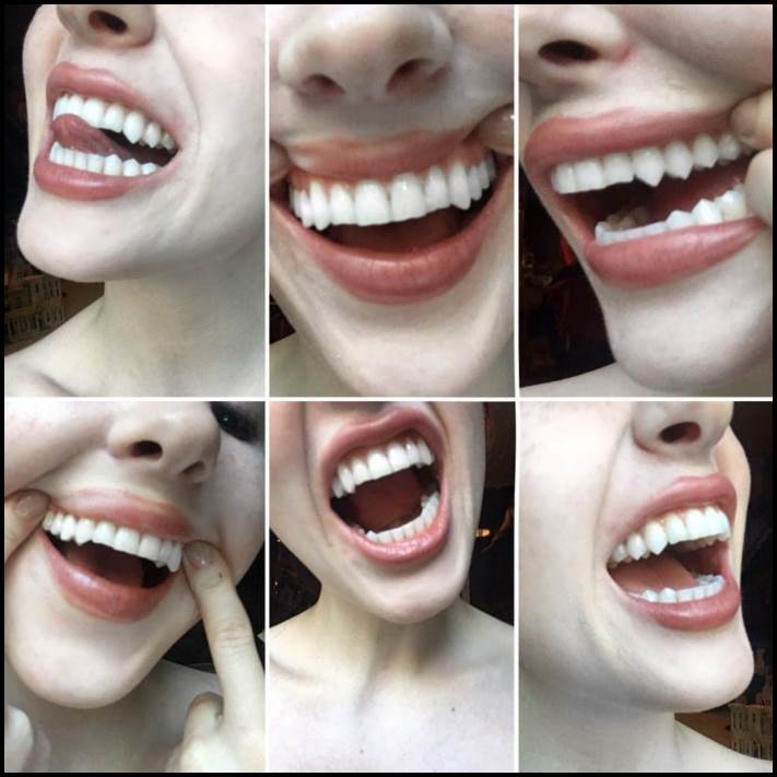 Մարդկանց անհավանական, բայց բավականին իրական մուտացիաներ. 16 լուսանկարների ընտրանի առանց Photoshop-ի