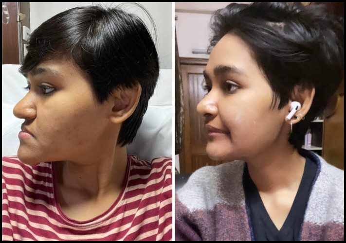 15 մարդ, ովքեր որոշեցին պլաստիկ վիրահատության ենթարկվել և այժմ միայն ափսոսում են, որ դա ավելի վաղ չեն արել