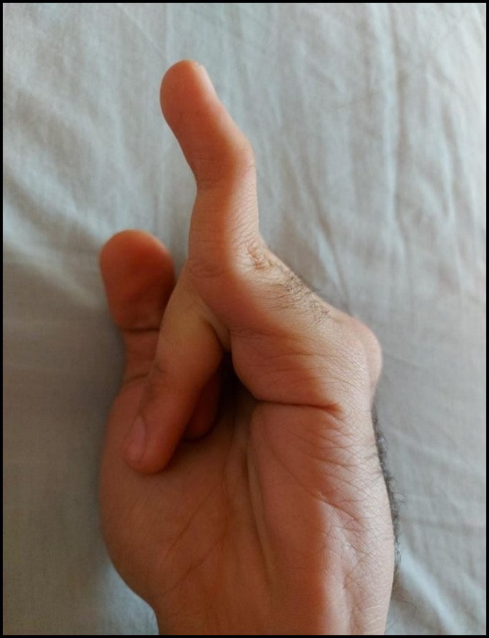 Մարդկանց անհավանական, բայց բավականին իրական մուտացիաներ. 16 լուսանկարների ընտրանի առանց Photoshop-ի