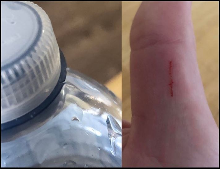 16 իրավիճակ, երբ մարդիկ տապալող ձախողումներ են ունեցել, և հիմա նրանք հստակ գիտեն, թե ինչ է ցավը