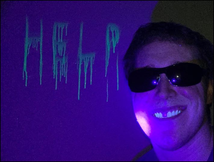 Մարդկանց 16 լուսանկար, որոնց մարմնի անսովոր հատկությունները նրանց տերերին առանձնացնում են մյուսներից