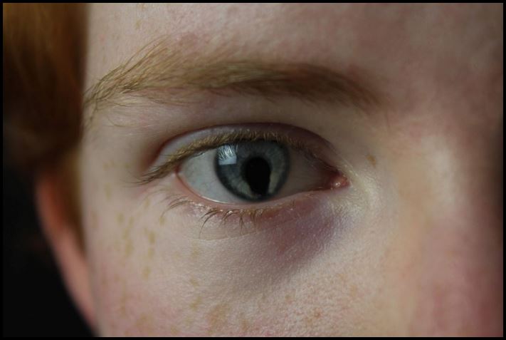 Մարդկանց անհավանական, բայց բավականին իրական մուտացիաներ. 16 լուսանկարների ընտրանի առանց Photoshop-ի