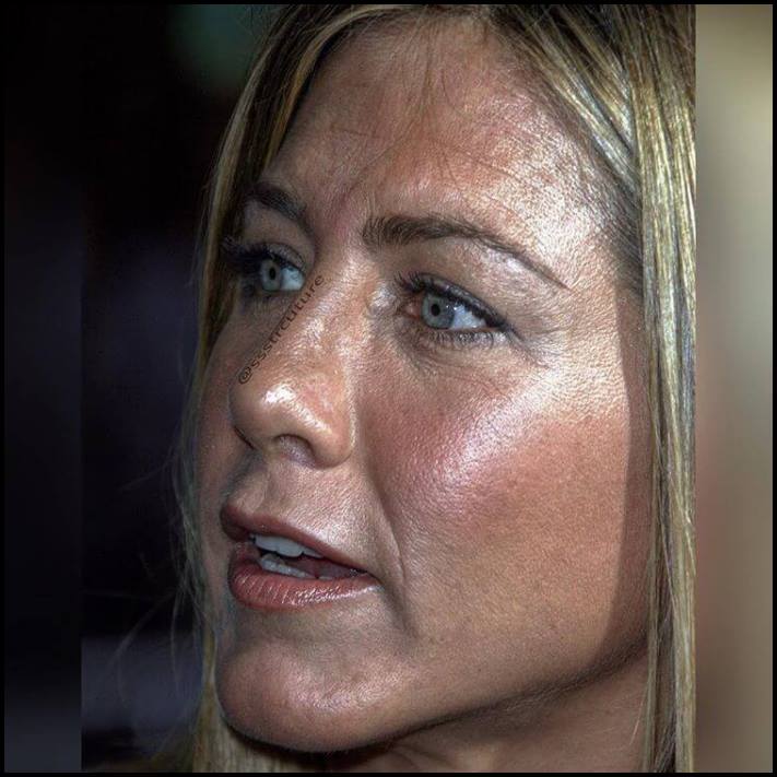 Բեղիկներ, ծակոտիներ և ցաներ: Ինչպիսին են համաշխարհային աստղերի դեմքերը մոտիկից