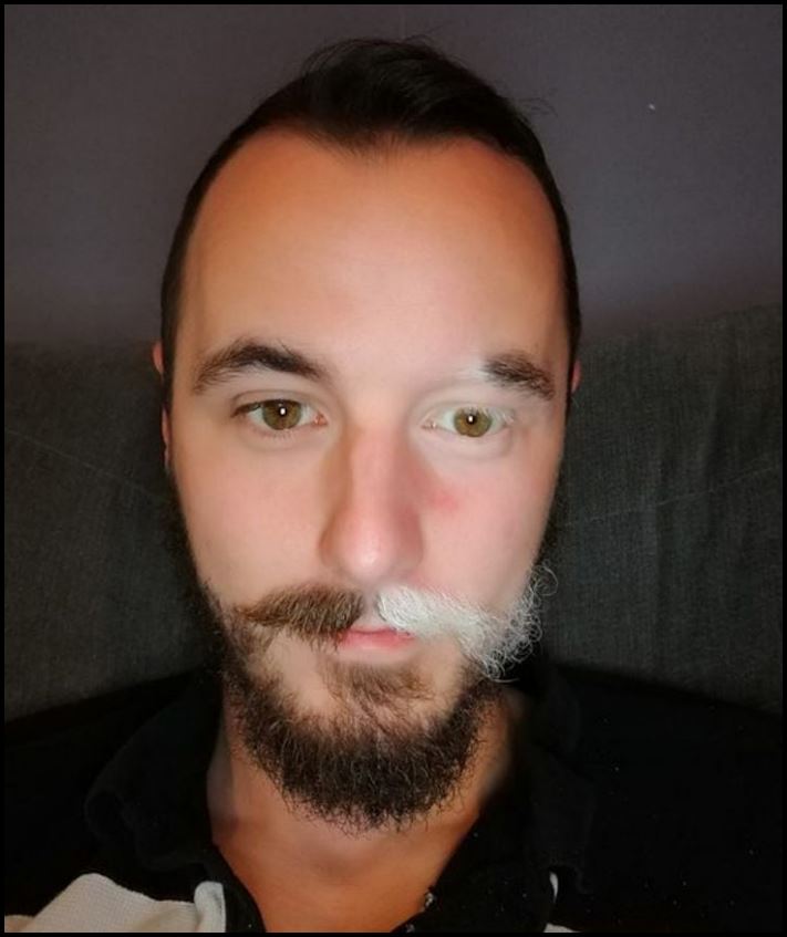 Մարդկանց անհավանական, բայց բավականին իրական մուտացիաներ. 16 լուսանկարների ընտրանի առանց Photoshop-ի