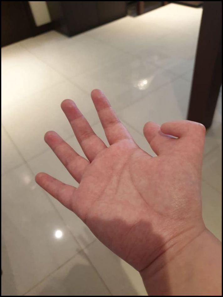 Մարդկանց անհավանական, բայց բավականին իրական մուտացիաներ. 16 լուսանկարների ընտրանի առանց Photoshop-ի