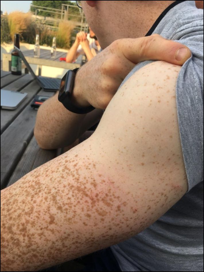 Մարդկանց 16 լուսանկար, որոնց մարմնի անսովոր հատկությունները նրանց տերերին առանձնացնում են մյուսներից