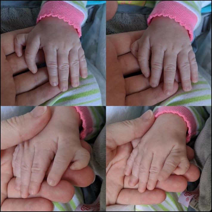 Մարդկանց 16 լուսանկար, որոնց մարմնի անսովոր հատկությունները նրանց տերերին առանձնացնում են մյուսներից