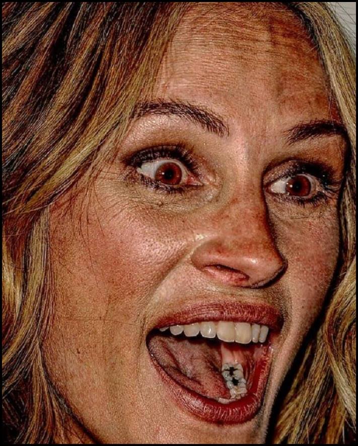 Բեղիկներ, ծակոտիներ և ցաներ: Ինչպիսին են համաշխարհային աստղերի դեմքերը մոտիկից