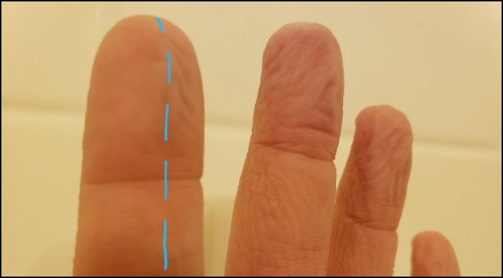 Մարդկանց 16 լուսանկար, որոնց մարմնի անսովոր հատկությունները նրանց տերերին առանձնացնում են մյուսներից